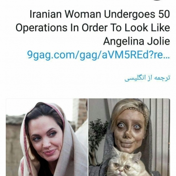 زن ایرانی ۵۰ عمل زیبایی را متحمل شده تا خود را مثلا شبیهه آنجلینا جولی کند!