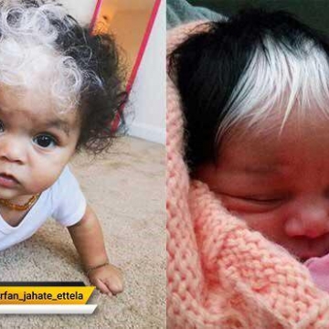 تصاویری از نوزادی با موهای سیاه و سفید