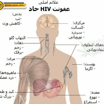 به این مرحله عفونت حاد HIV و یا سندرم حاد ویروسی گفته میشه