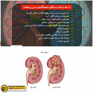 درفصل سردمراقب كليه هايتان باشيد!