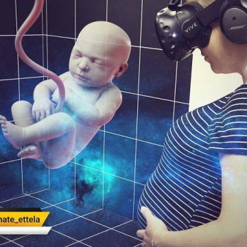 سونوگرافی باتکنولوژی واقعیت افزوده VR