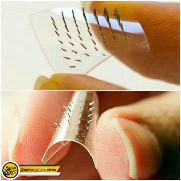 چسبهای تزریقی باسوزنهای بسیار کوتاه، دارو را وارد بدن میکنن