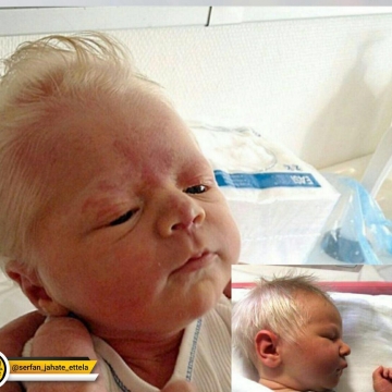 این کودک مجارستانی با مو های کاملا سفید متولد شده است!