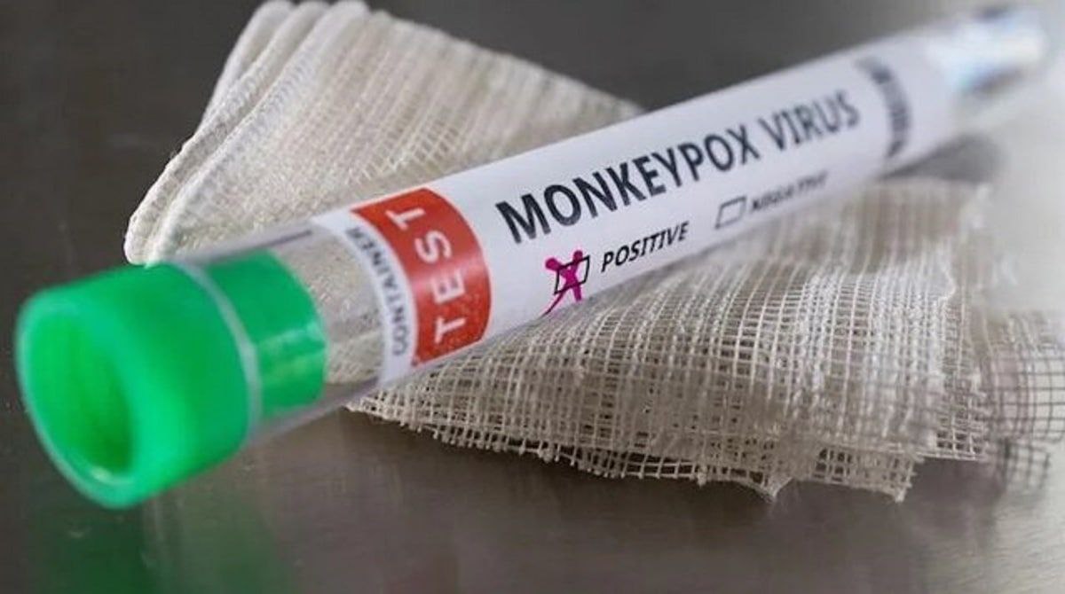 درخواست وزارت بهداشت برای خرید واکسن آبله میمونی/ بررسی موارد مشکوک در ۱۲ قطب دانشگاهی