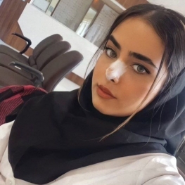 سقوط دختر جوان تبریزی در محل گود‌برداری