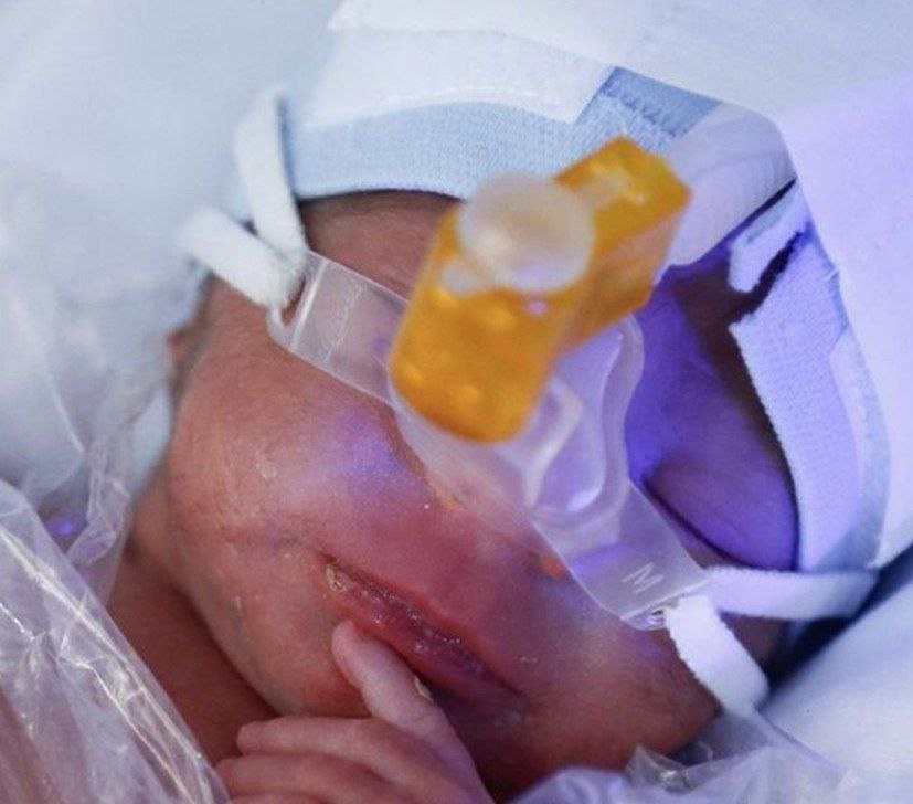فوت ۶ نوزاد در بیمارستان هاجر شهرکرد